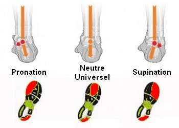 chaussure surpronation